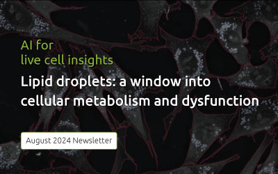 Newsletter August 2024: Lipid droplets, a window into cellular metabolism and dysfunction