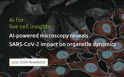 Newsletter June 2024: AI-powered Microscopy Reveals SARS-CoV-2 Impact on Organelle Dynamics