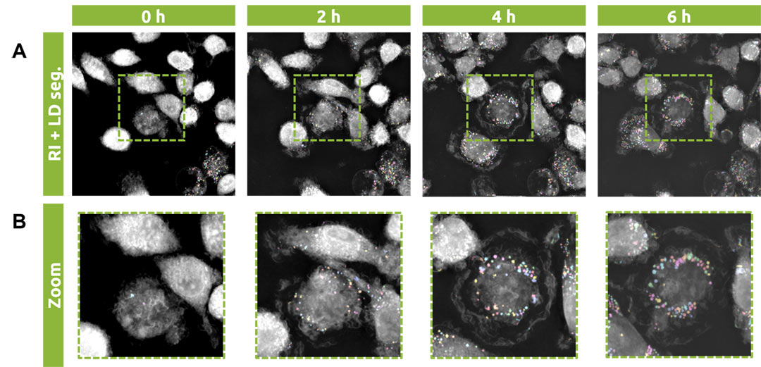 Timelapse refractive images overlaid with lipid droplet segmentations